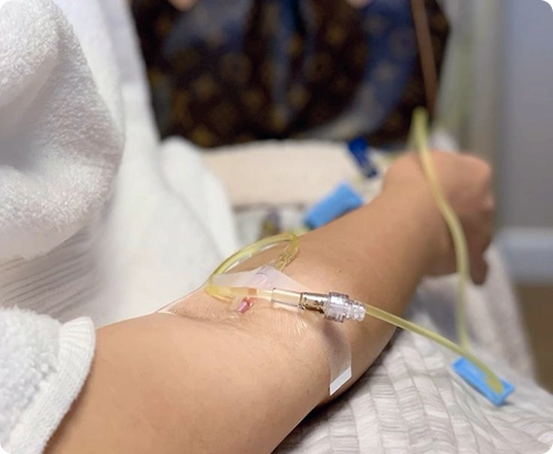 Vitamin C IV drip at SkinLab Bangalore